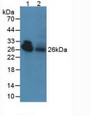 Western Blot; Lane1: Bovine Serum; Lane2: Bovine Heart.