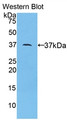 Western Blot; Sample: Recombinant protein.