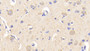 DAB staining on IHC-P; Samples: Human Cerebrum Tissue;  Primary Ab: 20μg/ml Rabbit Anti-Human PEX2 Antibody Second Ab: 2µg/mL HRP-Linked Caprine Anti-Rabbit IgG Polyclonal Antibody 