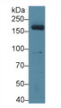 Western Blot; Sample: Mouse Serum; Primary Ab: 3µg/ml Rabbit Anti-Mouse MPO Antibody Second Ab: 0.2µg/mL HRP-Linked Caprine Anti-Rabbit IgG Polyclonal Antibody