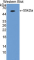 Western Blot; Sample: Recombinant protein.