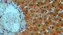 DAB staining on IHC-P; Samples: Human Liver Tissue;  Primary Ab: 10µg/ml Rabbit Anti-Human MPO Antibody Second Ab: 2µg/mL HRP-Linked Caprine Anti-Rabbit IgG Polyclonal Antibody 