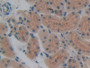 DAB staining on IHC-P; Samples: Rat Kidney Tissue; Primary Ab: 10µg/ml Rabbit Anti-Rat SOD4 Antibody Second Ab: 2µg/mL HRP-Linked Caprine Anti-Rabbit IgG Polyclonal Antibody