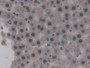 DAB staining on fromalin fixed paraffin- embedded liver tissue)