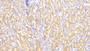 DAB staining on fromalin fixed paraffin-embedded Brain tissue)