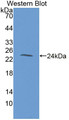 Western Blot; Sample: Recombinant protein.