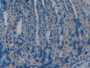DAB staining on IHC-P; Samples: Mouse Stomach Tissue;  Primary Ab: 10µg/ml Rabbit Anti-Mouse SST Ant