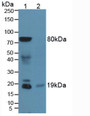 Western Blot; Sample: Lane1: Rat Heart Tissue; Lane2: Rat Stomach Tissue.