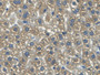 DAB staining on IHC-P; Samples: Mouse Liver Tissue; Primary Ab: 20µg/ml Rabbit Anti-Mouse HO2 Antibody Second Ab: 2µg/mL HRP-Linked Caprine Anti-Rabbit IgG Polyclonal Antibody