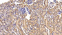 DAB staining on fromalin fixed paraffin-embedded Lung tissue)
