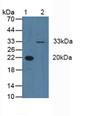 Western Blot; Sample: Lane1: Human Blood Cells; Lane2: Human Hela Cells.