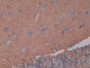DAB staining on IHC-P; Samples: Rat Cerebrum Tissue;  Primary Ab: 10µg/ml Rabbit Anti-Rat AQP4 Antib