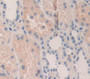 Aquaporin 2, Collecting Duct (Aqp2) Polyclonal Antibody, Cat#CAU27608