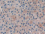 DAB staining on fromalin fixed paraffin- embedded prostate gland tissue)