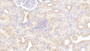 DAB staining on IHC-P; Samples: Human Kidney Tissue;  Primary Ab: 20μg/ml Rabbit Anti-Human PLAA Antibody Second Ab: 2µg/mL HRP-Linked Caprine Anti-Rabbit IgG Polyclonal Antibody 