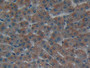 DAB staining on IHC-P; Samples: Human Liver Tissue; Primary Ab: 10µg/ml Rabbit Anti-Human LAMa1 Antibody Second Ab: 2µg/mL HRP-Linked Caprine Anti-Rabbit IgG Polyclonal Antibody