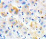 Used in DAB staining on fromalin fixed paraffin-embedded Liver tissue