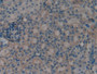 DAB staining on IHC-P; Samples: Rat Kidney Tissue; Primary Ab: 10µg/ml Rabbit Anti-Rat S100A11 Antibody Second Ab: 2µg/mL HRP-Linked Caprine Anti-Rabbit IgG Polyclonal Antibody