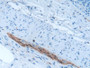 DAB staining on fromalin fixed paraffin- embedded brain tissue)