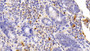 DAB staining on IHC-P; Samples: Bovine Small intestine Tissue; Primary Ab: 10μg/ml Rabbit Anti-Bovine S100B Antibody Second Ab: 2µg/mL HRP-Linked Caprine Anti-Rabbit IgG Polyclonal Antibody