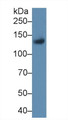 Western Blot; Sample: Rat Placenta lysate; Primary Ab: 1µg/ml Rabbit Anti-Rat LIFR Antibody Second Ab: 0.2µg/mL HRP-Linked Caprine Anti-Rabbit IgG Polyclonal Antibody