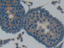 DAB staining on fromalin fixed paraffin- embedded kidney tissue)