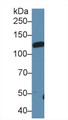 Western Blot; Sample: Rat Serum; Primary Ab: 1µg/ml Rabbit Anti-Rat LIFR Antibody Second Ab: 0.2µg/mL HRP-Linked Caprine Anti-Rabbit IgG Polyclonal Antibody