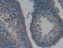 DAB staining on fromalin fixed paraffin- embedded kidney tissue)