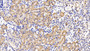 DAB staining on IHC-P; Sample: Mouse Kidney Tissue;  Primary Ab: 20ug/ml Rabbit Anti-Mouse LIFR Antibody Second Ab: 2µg/mL HRP-Linked Caprine Anti-Rabbit IgG Polyclonal Antibody 