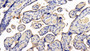 DAB staining on IHC-P; Sample: Human Placenta Tissue; Primary Ab: 20ug/ml Rabbit Anti-Human LIFR Antibody Second Ab: 2µg/mL HRP-Linked Caprine Anti-Rabbit IgG Polyclonal Antibody