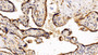 DAB staining on fromalin fixed paraffin-embedded Lung tissue)