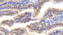 DAB staining on IHC-P; Samples: Bovine Small intestine Tissue;  Primary Ab: 20μg/ml Rabbit Anti-Bovine FABP2 Antibody Second Ab: 2µg/mL HRP-Linked Caprine Anti-Rabbit IgG Polyclonal Antibody 