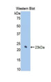 Western Blot; Sample: Recombinant protein.