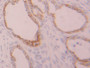DAB staining on IHC-P; Samples: Rat Ovary Tissue; Primary Ab: 20µg/ml Rabbit Anti-Rat KRT7 Antibody Second Ab: 2µg/mL HRP-Linked Caprine Anti-Rabbit IgG Polyclonal Antibody