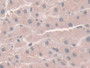 DAB staining on IHC-P; Samples: Human Liver Tissue; Primary Ab: 10µg/ml Rabbit Anti-Human NOX1 Antibody Second Ab: 2µg/mL HRP-Linked Caprine Anti-Rabbit IgG Polyclonal Antibody