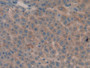 DAB staining on IHC-P; Samples: Rat Liver Tissue; Primary Ab: 10µg/ml Rabbit Anti-Rat MMP9 Antibody Second Ab: 2µg/mL HRP-Linked Caprine Anti-Rabbit IgG Polyclonal Antibody