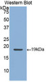 Western Blot; Sample: Recombinant protein.