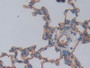 DAB staining on IHC-P; Samples: Rat Lung Tissue; Primary Ab: 10µg/ml Rabbit Anti-Rat ICAM1 Antibody Second Ab: 2µg/mL HRP-Linked Caprine Anti-Rabbit IgG Polyclonal Antibody