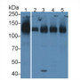 Western Blot; Sample: Lane1: Porcine Lung lysate; Lane2: Porcine Liver lysate; Lane3: Porcine Kidney lysate; Lane4: Porcine Spleen lysate; Lane5：Porcine Lymph node lysate; Primary Ab: 1µg/ml Rabbit Anti-Porcine ICAM1 Antibody; Second Ab: 0.2µg/mL HRP-Linked Caprine Anti-Rabbit IgG Polyclonal Antibody;