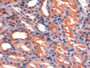 DAB staining on IHC-P; Samples: Porcine Kidney Tissue; Primary Ab: 10µg/ml Rabbit Anti-Porcine ICAM1 Antibody Second Ab: 2µg/mL HRP-Linked Caprine Anti-Rabbit IgG Polyclonal Antibody