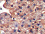 DAB staining on IHC-P; Samples: Porcine Liver Tissue; Primary Ab: 10µg/ml Rabbit Anti-Porcine ICAM1 Antibody Second Ab: 2µg/mL HRP-Linked Caprine Anti-Rabbit IgG Polyclonal Antibody