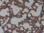 DAB staining on IHC-P; Samples: Mouse Lung Tissue;  Primary Ab: 10µg/ml Rabbit Anti-Mouse ICAM1 Anti