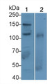 Western Blot; Sample: Lane1: Rat Serum; Lane2: Rat Spleen lysate; Primary Ab: 1μg/ml Rabbit Anti-Rat VCAM1 Antibody; Second Ab: 0.2µg/mL HRP-Linked Caprine Anti-Rabbit IgG Polyclonal Antibody;