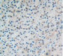 Figure. DAB staining on IHC-P; Samples: Human Liver Tissue.