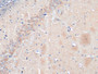 DAB staining on IHC-P; Samples: Rat Cerebrum Tissue; Primary Ab: 20µg/ml Rabbit Anti-Rat NSE Antibody Second Ab: 2µg/mL HRP-Linked Caprine Anti-Rabbit IgG Polyclonal Antibody