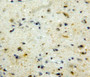 DAB staining on fromalin fixed paraffin-embedded brain tissue)