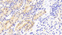 DAB staining on IHC-P; Samples: Rat Kidney Tissue; Primary Ab: 10μg/ml Rabbit Anti-Rat LAP Antibody Second Ab: 2µg/mL HRP-Linked Caprine Anti-Rabbit IgG Polyclonal Antibody