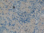 DAB staining on IHC-P; Samples: Rat Kidney Tissue; Primary Ab: 10µg/ml Rabbit Anti-Rat KRT12 Antibody Second Ab: 2µg/mL HRP-Linked Caprine Anti-Rabbit IgG Polyclonal Antibody
