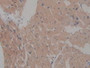 DAB staining on IHC-P; Samples: Rat Heart Tissue.