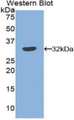 Western Blot; Sample: Recombinant protein.